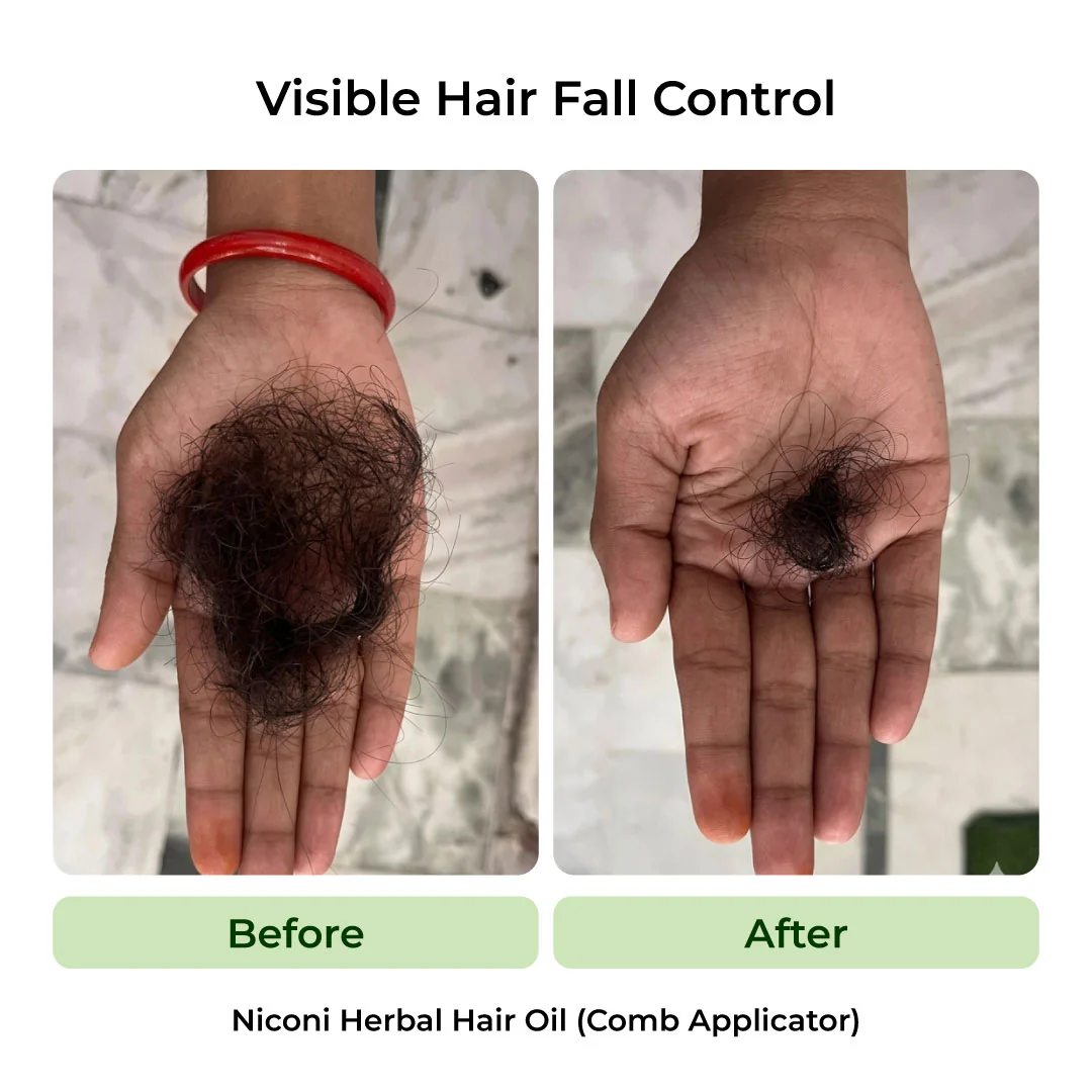 The Anti-Dandruff Hair Revival Combo - Image 3