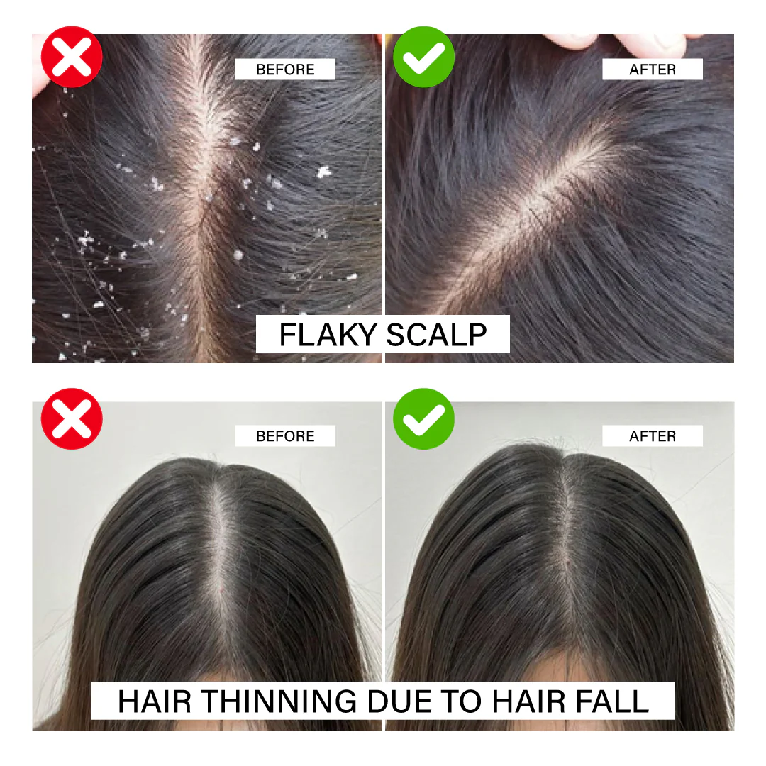 Niconi Herbal Hair Oil (Comb Applicator) 200ml | Money Back Guarantee - Image 5