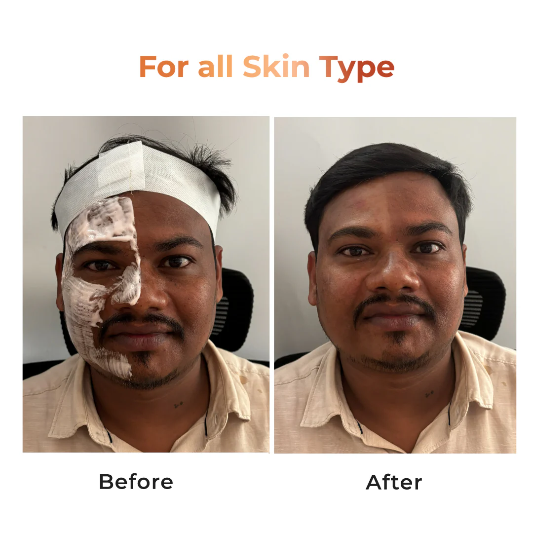 Niconi Tan Vanish Gluta-Kojic Skin Polish - Salon - Image 3