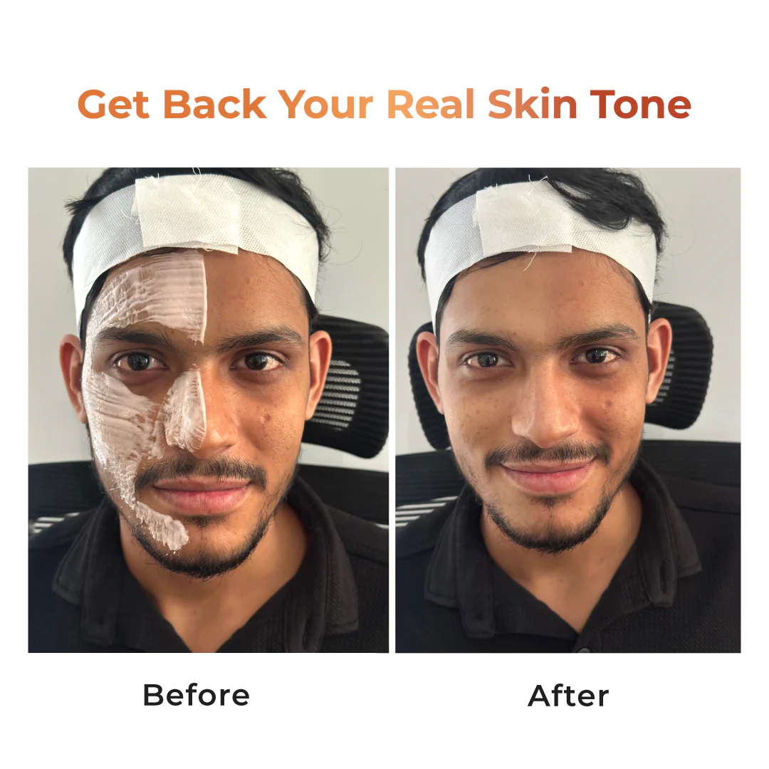 Niconi Tan Vanish Gluta-Kojic Skin Polish - Salon - Image 5
