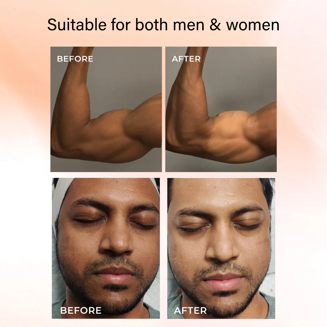 Niconi Tan Vanish Gluta-Kojic Skin Polish  For Easy Tan Removal - Image 3