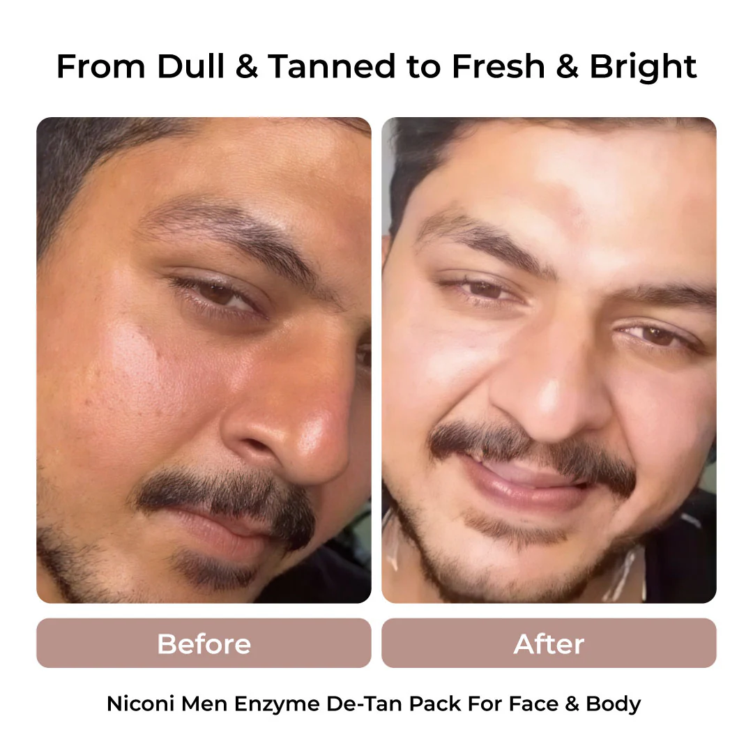 The Summer Shield Combo for Men - Image 4